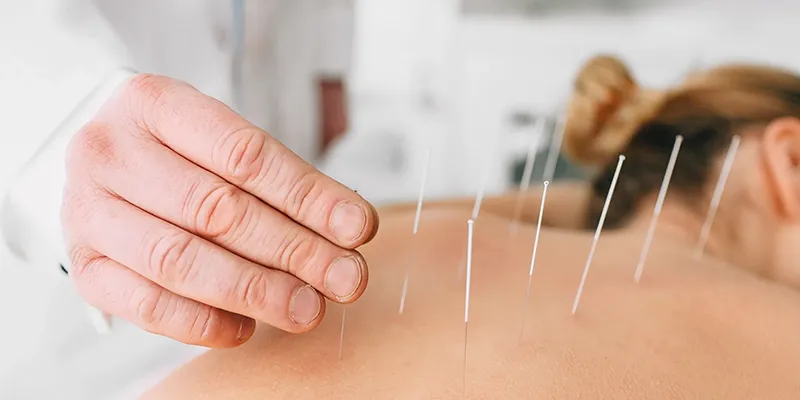 Tai Chi Acupuncture